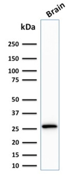 CALB2 Antibody