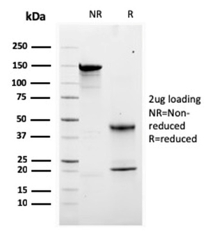 CALB2 Antibody