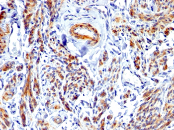 CALD1 Antibody