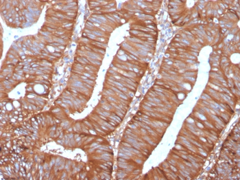 CAST Antibody