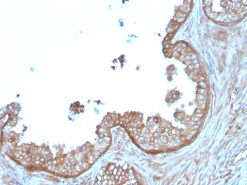 CAST Antibody