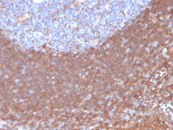CAST Antibody