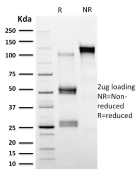 CAST Antibody
