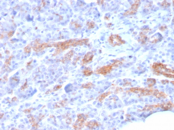 ABCC3 Antibody