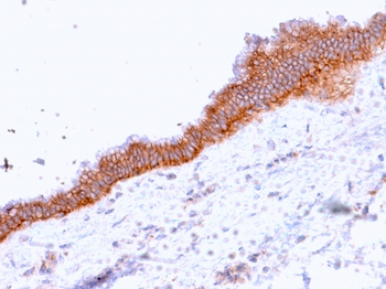 ABCC3 Antibody