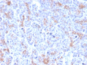 ABCC3 Antibody