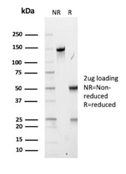 ABCC3 Antibody