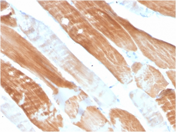 ACTN2 Antibody
