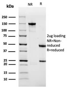 ACTN2 Antibody