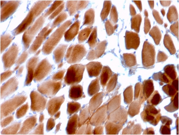 ACTN2 Antibody