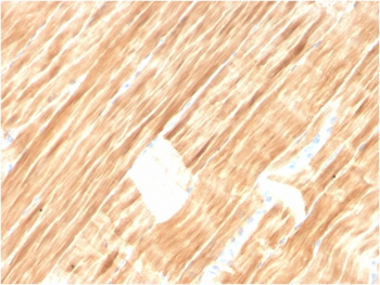 ACTN2 Antibody