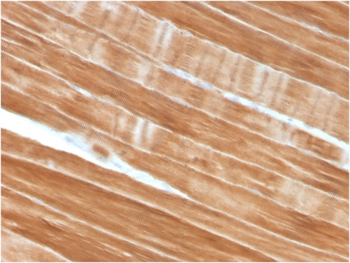 ACTN2 Antibody
