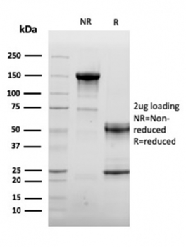 ACTN2 Antibody