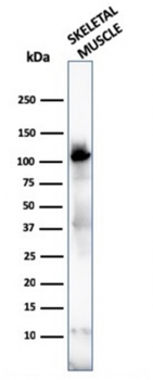 ACTN2 Antibody