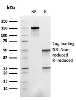 ACTN2 Antibody