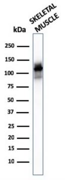 ACTN2 Antibody