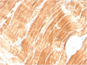 ACTN2 Antibody