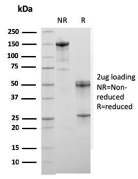 ACTN2 Antibody