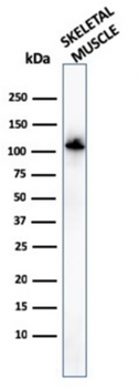ACTN2 Antibody