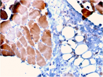 ACTN2 Antibody