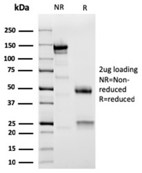 ACTN2 Antibody
