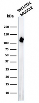 ACTN2 Antibody