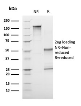 CD1A Antibody