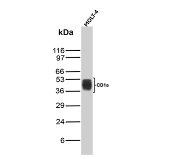 CD1A Antibody