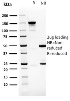 PDLIM1 Antibody