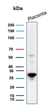 PDLIM1 Antibody