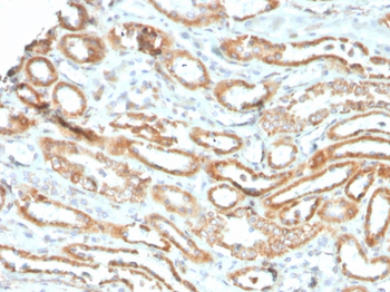 AURKB Antibody