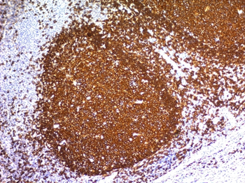 MS4A1 Antibody