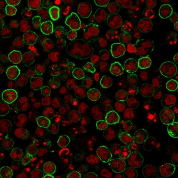 MS4A1 Antibody