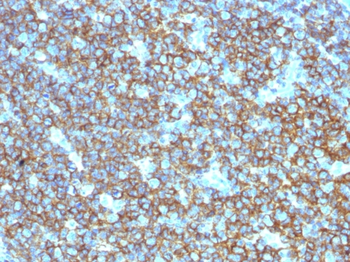 MS4A1 Antibody