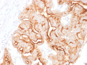 MUC16 Antibody