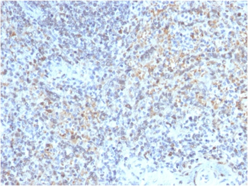 CD40LG Antibody