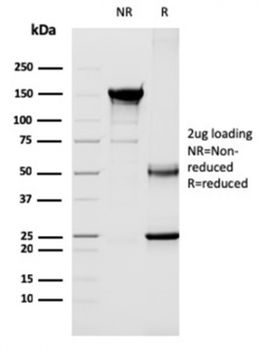 CD40LG Antibody