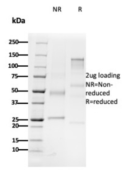 CD79B Antibody