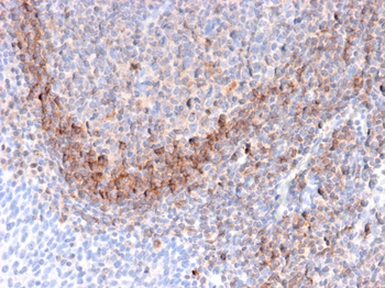 CD79B Antibody