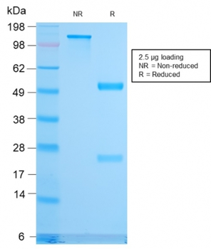 CD79B Antibody