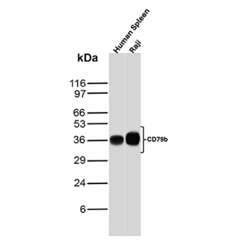 CD79B Antibody