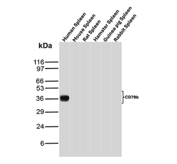 CD79B Antibody