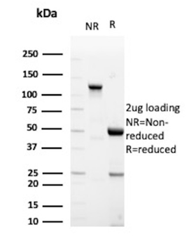 CD79B Antibody