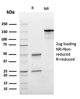 CDH1 Antibody