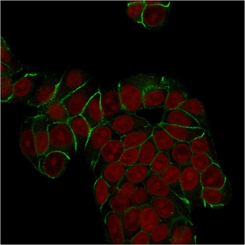 CDH1 Antibody