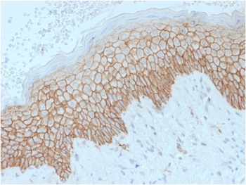 CDH1 Antibody