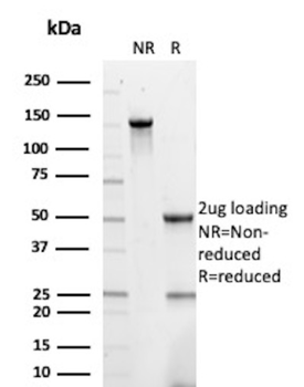 CDH1 Antibody