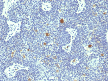 HPV-18 (Human Papilloma Virus 18) Antibody