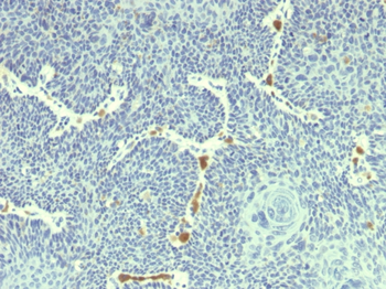 HPV-18 (Human Papilloma Virus 18) Antibody