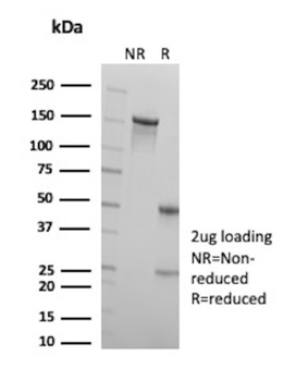 HPV-18 (Human Papilloma Virus 18) Antibody